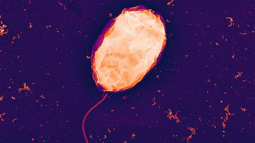 Close-up picture of a bacterium